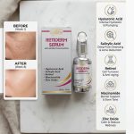 Retiderm (Lightweight Serum)