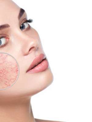 Dry and Sensitive Skin, Anti  Aging