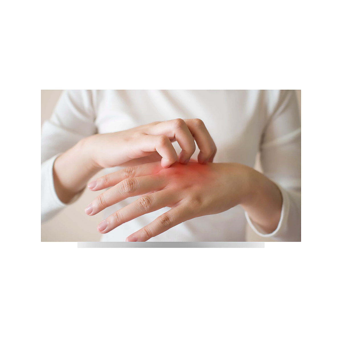 Anti scabies, Anti fungus, and Anti Dandruff Bundle (Pack of 2)